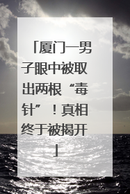 厦门一男子眼中被取出两根“毒针”！真相终于被揭开